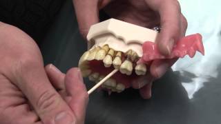 What is Periodontal Disease [upl. by Aurilia227]