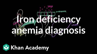 Iron deficency anemia diagnosis  Hematologic System Diseases  NCLEXRN  Khan Academy [upl. by Yddor]