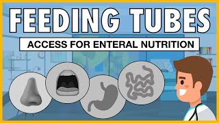 Using an Enteral Food Pump [upl. by Edahsalof]