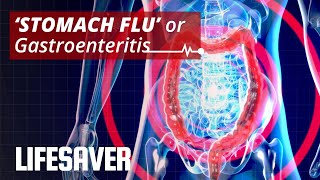 Gastroenteritis or ‘Stomach Flu’ Symptoms Treatment amp Prevention  LIFESAVER [upl. by O'Driscoll]