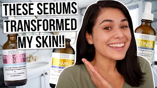 3 BEST Serums for Acne and Hyperpigmentation UNDER 16 [upl. by Ettolrahc520]