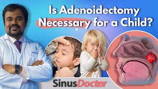 What are Adenoids  Causes  Symptoms  Is Adenoidectomy Necessary for a Child  SinusDoctor [upl. by Kama570]