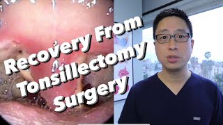 PostTonsillectomy Overview pain control diet bleeding concerns physical limitations [upl. by Rusticus326]