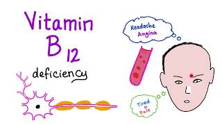 Vitamin B12 Cobalamin Deficiency  Causes Symptoms Diagnosis amp Management  Hematology Series [upl. by Valeda]