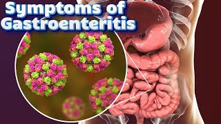 Symptoms of Gastroenteritis [upl. by Graybill]