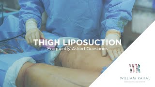 Thigh Liposuction Recovery amp other FAQs Frequently Asked Questions [upl. by Tnomad]