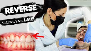 How To Treat Gum Disease [upl. by Ennagrom]