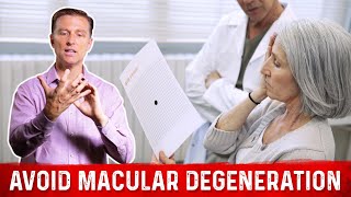 How to Prevent Macular Degeneration – Dr Berg [upl. by Aniled992]