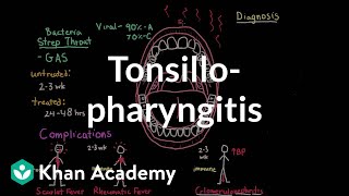 Tonsillopharyngitis  Complications diagnosis and treatment  NCLEXRN  Khan Academy [upl. by Ikairik288]