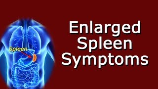 Enlarged Spleen Symptoms [upl. by Hildegarde]