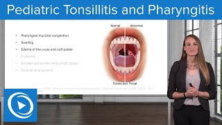 Pediatric Tonsillitis and Pharyngitis – Pediatric Nursing  Lecturio [upl. by Ati876]