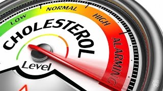 HOW I LOWERED MY CHOLESTEROL IN JUST 30 DAYS [upl. by Omixam]