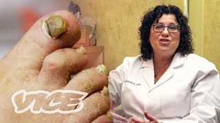 Meet a Toenail Fungus Expert [upl. by Ahseyt]