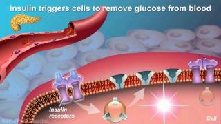 Understanding Type 2 Diabetes [upl. by Adnoval]