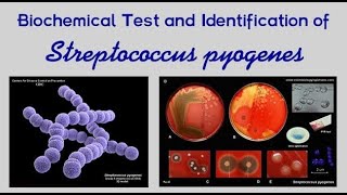 Pharyngitis Part 2 Bacterial Pharyngitis Streptococcus Pyogenes [upl. by Aivirt857]