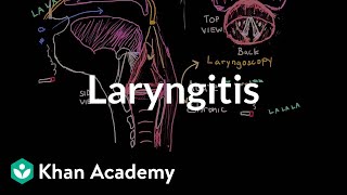 Laryngitis diagnosis treatment and prevention  NCLEXRN  Khan Academy [upl. by Tabby]