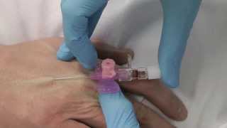 Cannulation How to gain IV access [upl. by Fahland]