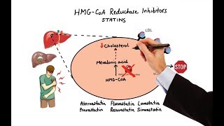 Cholesterol  Causes Symptoms and Treatment Options [upl. by Nevuer910]