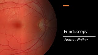 Retina  An Introduction  Part 1 [upl. by Akahs370]