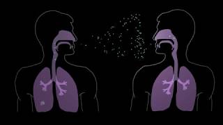 How Tuberculosis Begins [upl. by Zingg]