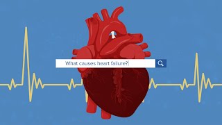 What Causes Heart Failure [upl. by Cassaundra]