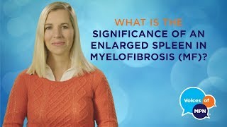 Why Is Spleen Size Important in Myelofibrosis [upl. by Phelps]