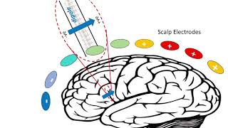 EEG  Electrical Brainwaves [upl. by Esorbma42]