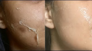 How to remove DEAD SKIN from Face DEAD SKIN PEEL OFF MASK  Open Pores  Cucumber Mask [upl. by Tanya]