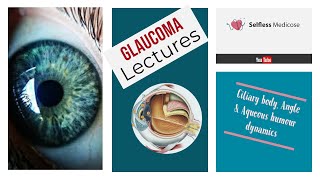 SURGICAL PROCEDURES IN GLAUCOMA made easy part 1 [upl. by Islaen]