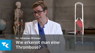 Wie erkennt man eine Thrombose  Dr Johannes Wimmer [upl. by Michey277]