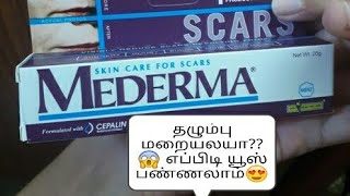 mederma advanced scar gel review in tamil [upl. by Tobe]