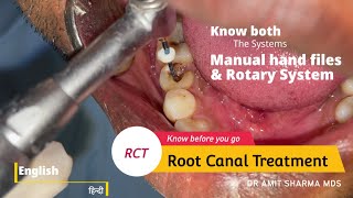 How Root canal treatment  RCT is done  Know both Manual and Rotary system [upl. by Eadahs739]