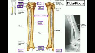 Anatomy  Specific Parts of the Tibia amp Fibula  Left vs Right [upl. by Moses]