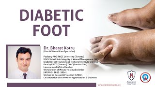 What to Expect Diabetic Foot Examination  A Guide By SGH Podiatry [upl. by Anyahs4]