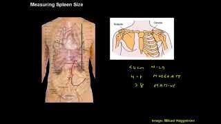 Measuring Spleen Size  Clinical Skills Made Easy [upl. by Idnahc62]