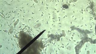 Protists Amoeba Euglena Paramecium [upl. by Eetnom]