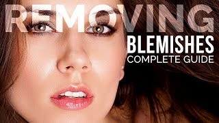 Complete Guide to Removing Blemishes in Photoshop [upl. by Allys487]