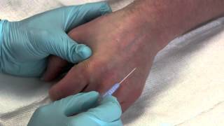 Intravenous Catheter Placement [upl. by Brendis938]