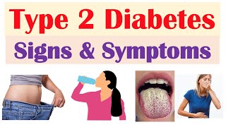 Type 2 Diabetes Signs amp Symptoms amp Why They Occur amp Associated Conditions [upl. by Enialb]