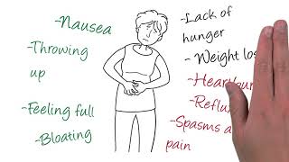 Understanding diabetic gastroparesis [upl. by Niraa]