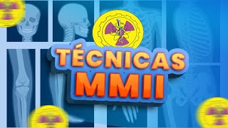 TODAS INCIDÊNCIAS MMII  Radiologando [upl. by Popper974]