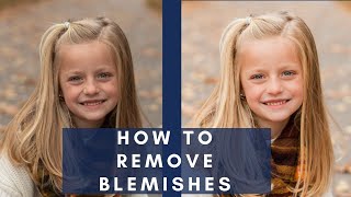 How to Remove Blemishes in Lightroom [upl. by Kimberli]