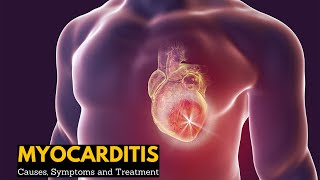 Myocarditis Causes Signs and Symptoms Diagnosis Treatment [upl. by Walt]