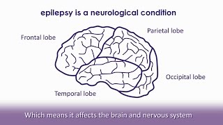 What is epilepsy  Epilepsy Society [upl. by Auqinahs429]