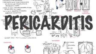 Pericarditis  Overview signs and symptoms pathophysiology diagnosis treatment [upl. by Rosinski261]