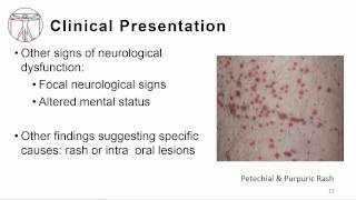 1 Overview meningitis and encephalitis [upl. by Hudgens]