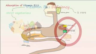 Megaloblastic Anemia Part 1 Vitamin B12 Deficiency Anemia [upl. by Ertnod32]