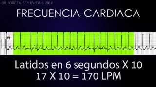 Electrocardiografía Básica Parte 24 [upl. by Colley]