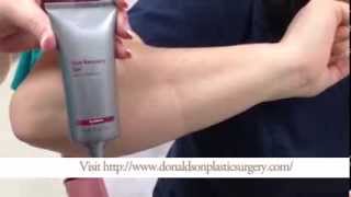 How To Apply Scar Gel or Cream [upl. by Tibold]