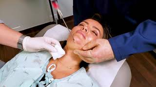 In Office Chin Liposuction [upl. by Lauro]